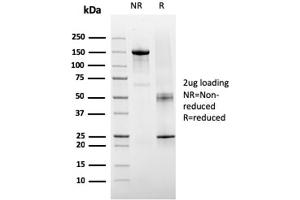 SDS-PAGE Analysis Purified TIGIT-Monospecific Mouse Monoclonal Antibody (TIGIT/3106).