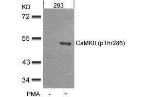 Western blot analysis of extracts from 293 cells untreated or treated with PMA using CaMKII(Phospho-Thr286) Antibody.