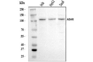 Western blot analysis of ADAR1/ADAR using anti-ADAR1/ADAR antibody (ABIN7598956). (ADAR anticorps  (AA 1-1152))