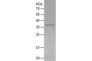 Western Blotting (WB) image for Cytochrome P450, Family 7, Subfamily B, Polypeptide 1 (CYP7B1) (AA 39-180) protein (His-IF2DI Tag) (ABIN7122584)