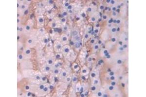 IHC-P analysis of Kidney tissue, with DAB staining. (SCARB1 anticorps  (AA 33-440))