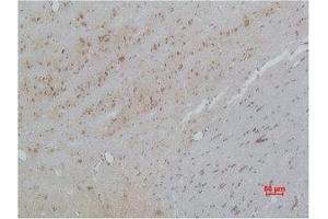 Immunohistochemical analysis of paraffin-embedded Rat Brain Tissue using CACNB3 Polyclonal Antibody.