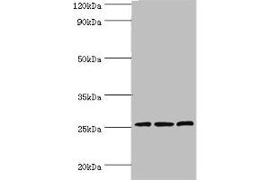 Western blot All lanes: Claudin-14 antibody at 4 μg/mL Lane 1: Rat liver tissue Lane 2: Mouse kidney tissue Lane 3: Hela whole cell lysate Secondary Goat polyclonal to rabbit IgG at 1/10000 dilution Predicted band size: 26 kDa Observed band size: 26 kDa (CLDN14 anticorps  (AA 140-239))
