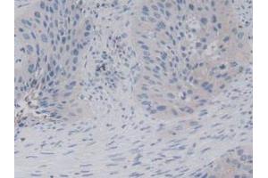 Figure. (CD94 anticorps  (AA 32-179))