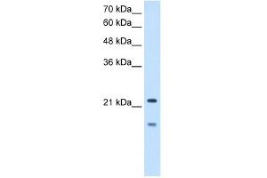 MMP7 antibody used at 2. (MMP7 anticorps)