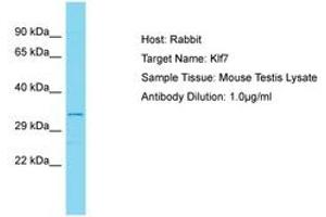 Image no. 1 for anti-Kruppel-Like Factor 7 (Ubiquitous) (KLF7) (AA 133-182) antibody (ABIN6750308)