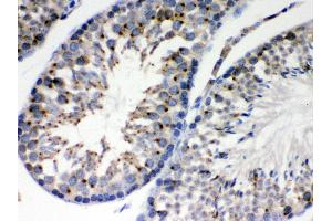 Anti- EBAG9 Picoband antibody,IHC(P) IHC(P): Mouse Testis Tissue