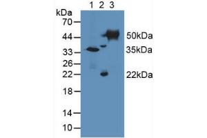 Figure. (TUBD1 anticorps  (AA 236-455))
