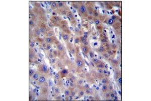 Immunohistochemistry analysis in Formalin Fixed, Paraffin Embedded Human liver tissue stained with FADS2 Antibody (N-term) followed by peroxidase conjugation of the secondary antibody and DAB staining. (FADS2 anticorps  (N-Term))