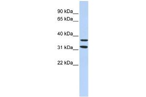 WB Suggested Anti-ZNF254 Antibody Titration:  0. (ZNF254 anticorps  (Middle Region))