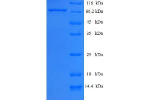 SDS-PAGE (SDS) image for Parkinson Protein 2, E3 Ubiquitin Protein Ligase (Parkin) (PARK2) (AA 1-465), (full length) protein (His-SUMO Tag) (ABIN5710065)