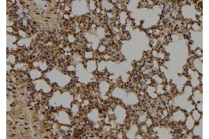 ABIN6274019 at 1/100 staining Mouse lung tissue by IHC-P. (ID1 anticorps  (Internal Region))