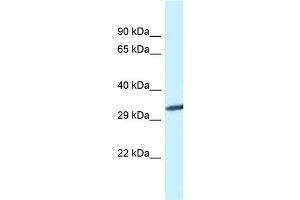 WB Suggested Anti-Gnmt Antibody   Titration: 1. (GNMT anticorps  (C-Term))