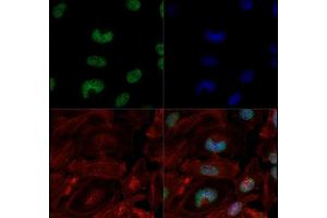 Immunofluorescence of Anti-Histone H3 Me3 K4/Ac K9 me1: Histone H3 Trimethyl Lys4/ac Lys9 antibody was tested at 1:10 in HeLa cells with FITC (green).