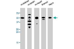 The park polyclonal antibody  is used in Western blot to detect park in, from left to right, mouse kidney, mouse brain, mouse heart, Ramos, and HeLa tissue lysates . (Parkin anticorps  (N-Term))