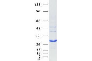 Validation with Western Blot