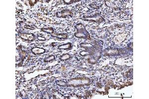 IHC analysis of UBA6 using anti-UBA6 antibody (ABIN7602559). (UBA6 anticorps  (AA 85-1033))