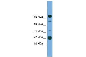 WB Suggested Anti-TMEM107 Antibody Titration:  0. (TMEM107 anticorps  (N-Term))