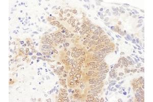 anti-Phosphoribosylglycinamide Formyltransferase (GART) (AA 200-250) antibody