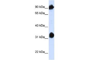 HSPA4 antibody used at 1 ug/ml to detect target protein. (HSPA4 anticorps  (N-Term))