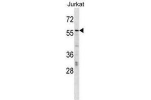CBFA2T2 Antibody (N-term) western blot analysis in Jurkat cell line lysates (35µg/lane). (CBFA2T2 anticorps  (N-Term))