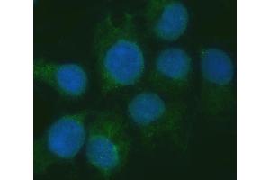 IF analysis of RGS7 using anti-RGS7 antibody (ABIN7599430).