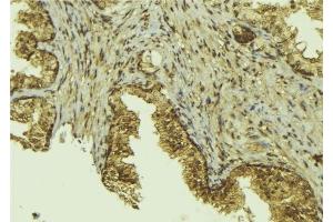 ABIN6276536 at 1/100 staining Mouse colon tissue by IHC-P. (CTCF anticorps  (C-Term))