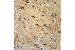 Formalin fixed, paraffin embedded brain tissue stained with RGR Antibody  followed by peroxidase conjugation of the secondary antibody and DAB staining. (RGR anticorps  (Middle Region))