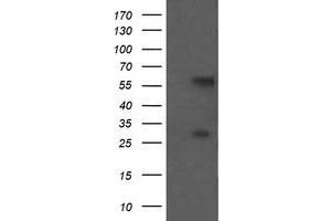 Image no. 1 for anti-Chaperonin Containing TCP1, Subunit 8 (Theta)-Like 2 (CCT8L2) antibody (ABIN1497483) (CCT8L2 anticorps)