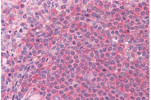 Human Spleen: Formalin-Fixed, Paraffin-Embedded (FFPE)