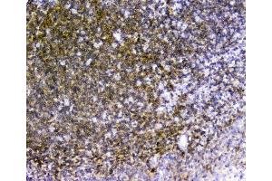 IHC analysis of TRAIL using anti-TRAIL antibody (ABIN5519065).