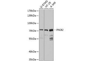 Western blot analysis of extracts of various cell lines, using P antibody (ABIN6128411, ABIN6145164, ABIN6145166 and ABIN6215841) at 1:3000 dilution. (PADI2 anticorps  (AA 1-200))