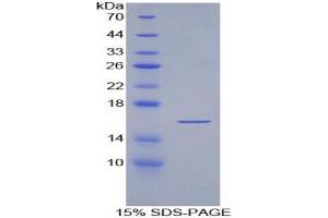 SDS-PAGE analysis of Human alpha Fodrin Protein.