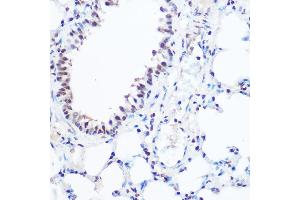 Immunohistochemistry of paraffin-embedded mouse lung using S Rabbit pAb (ABIN6128698, ABIN6147392, ABIN6147393 and ABIN6215703) at dilution of 1:100 (40x lens). (SART3 anticorps  (AA 664-963))