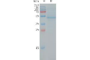 Human RHOC(1-189) Protein, hFc Tag on SDS-PAGE under reducing condition.