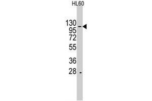Western blot analysis of HIRA polyclonal antibody  in HL-60 cell lysate (35 ug/lane). (HIRA anticorps  (Internal Region))