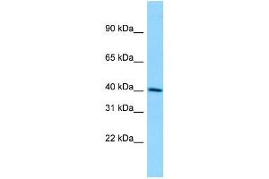 WB Suggested Anti-DMKN Antibody Titration: 1. (Dermokine anticorps  (C-Term))
