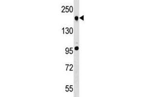 TET2 antibody western blot analysis in A549 lysate.