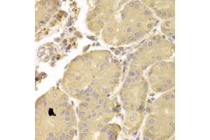 Immunohistochemistry of paraffin-embedded human stomach using ATG7 antibody (ABIN6292614) at dilution of 1:100 (40x lens). (ATG7 anticorps)