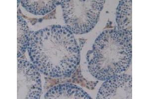 IHC-P analysis of Mouse Testis Tissue, with DAB staining. (PAOX anticorps  (AA 130-356))