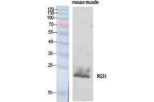 Western Blotting (WB) image for anti-Regulator of G-Protein Signaling 1 (RGS1) (Internal Region) antibody (ABIN3177204) (RGS1 anticorps  (Internal Region))