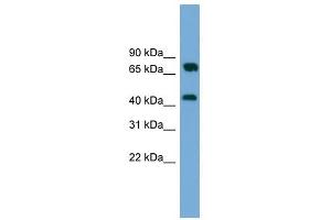 MAT2A antibody used at 1 ug/ml to detect target protein. (MAT2A anticorps  (Middle Region))