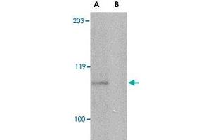 Western blot analysis of GP6 in mouse brain lysate with GP6 polyclonal antibody  at 1 ug/mL in either the absence or (B) the presence of blocking peptide. (GP6 anticorps  (Internal Region))