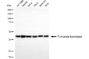 anti-Fumarate Hydratase (FH) antibody