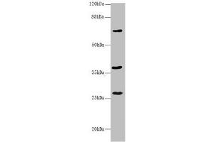 Western blot All lanes: GNS antibody at 3. (GNS anticorps  (AA 293-552))