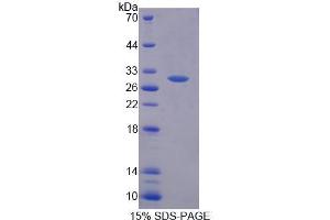 SDS-PAGE analysis of Human PGM2 Protein. (Phosphoglucomutase 2 Protein (PGM2))