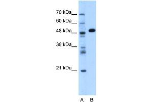 WB Suggested Anti-GPT Antibody Titration:  1. (ALT anticorps  (N-Term))