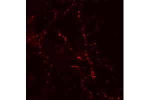 Labeling of recycling vesicles in cultured neurons from rat cerebellum (dilution 1 : 100)
