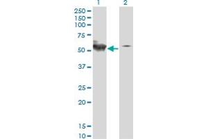 Western Blot analysis of STK38 expression in transfected 293T cell line by STK38 monoclonal antibody (M01A), clone 2G8-1F3. (STK38 anticorps  (AA 1-465))