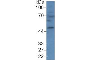 Detection of CPB1 in Mouse Spleen lysate using Polyclonal Antibody to Carboxypeptidase B1, Tissue (CPB1) (CPB1 anticorps  (AA 109-415))
